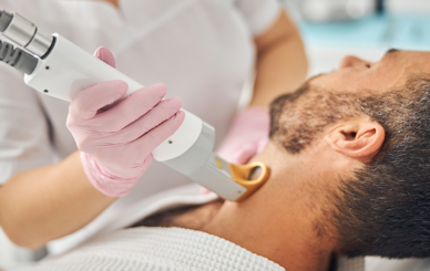 لیزر موهای زائد کرکی و سفید و تار نازک